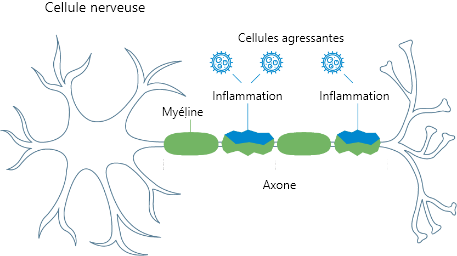 A diagram of a body’s central nervous system, including the brain and spinal cord. Another image shows myelin, the protective coating around the nerve.